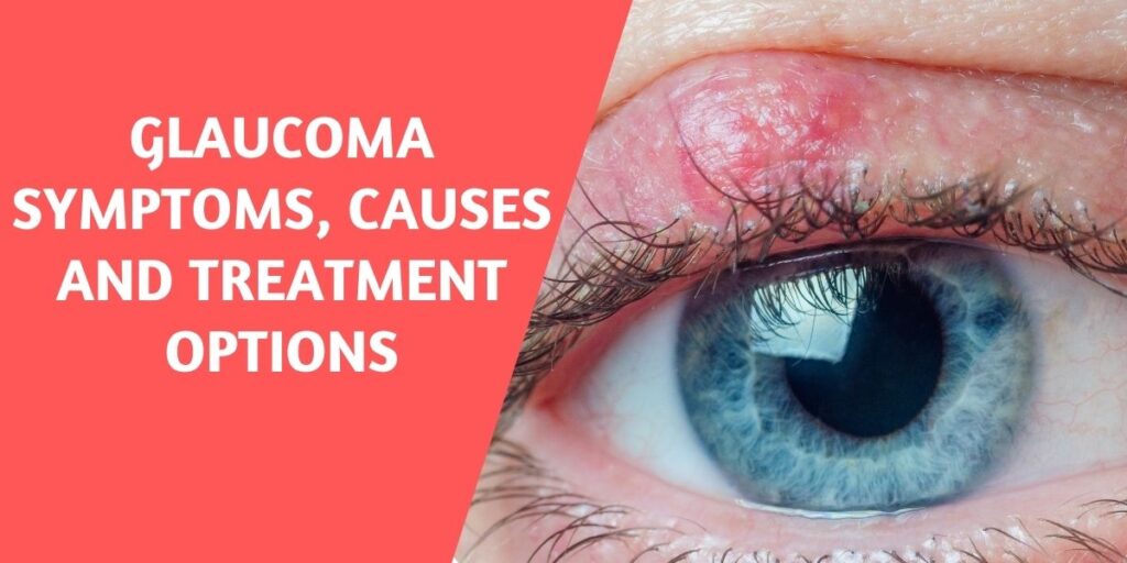 Glaucoma