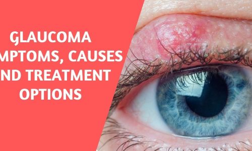 Glaucoma